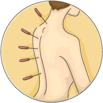 רפואה סינית