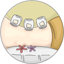 שיאצו וכוסות רוח